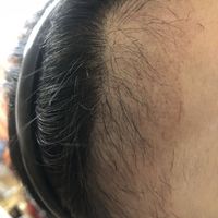發(fā)際線用戶(hù)圖片