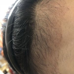 发际线分享社区