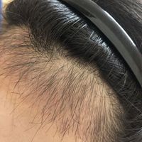 發(fā)際線用戶(hù)圖片