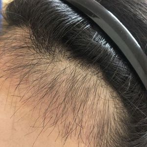 发际线分享社区