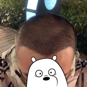 发际线分享社区