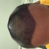 發(fā)際線用戶圖片
