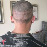 發(fā)際線用戶圖片