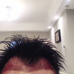 发际线分享社区