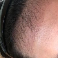 發(fā)際線用戶圖片
