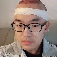 發(fā)際線用戶圖片
