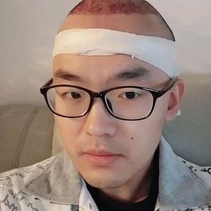 发际线分享社区