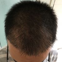 失敗修復(fù)用戶圖片