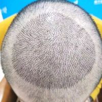 禿頂用戶圖片