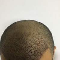 發(fā)際線用戶圖片