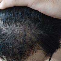 發(fā)際線用戶圖片