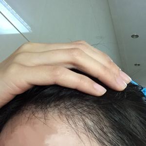 发际线分享社区