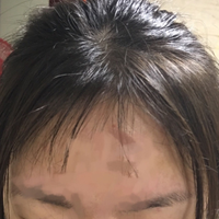 發(fā)際線用戶(hù)圖片