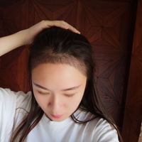 發(fā)際線用戶(hù)圖片