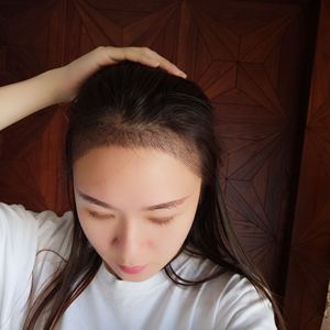 发际线分享社区
