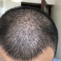 發(fā)際線用戶圖片