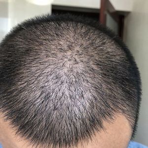 发际线分享社区