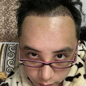 发际线分享社区