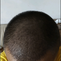發(fā)際線用戶圖片