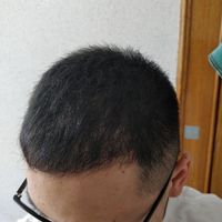 發(fā)際線用戶圖片