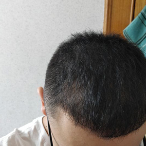 发际线分享社区