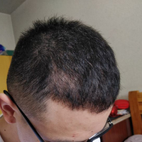 發(fā)際線用戶圖片