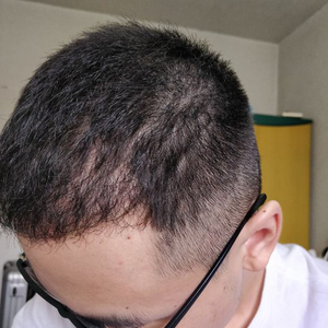 发际线分享社区