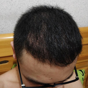 发际线分享社区