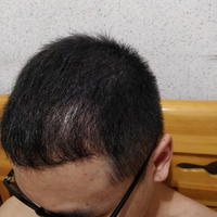 發(fā)際線用戶圖片