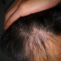 發(fā)際線用戶圖片