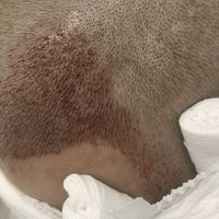 發(fā)際線用戶圖片