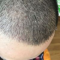 發(fā)際線用戶圖片