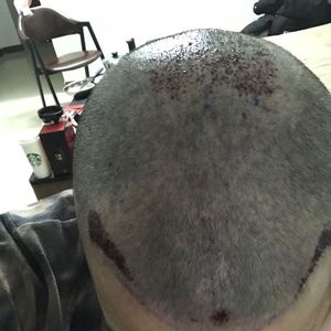发际线分享社区