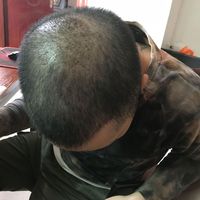 禿頂用戶圖片