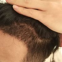 發(fā)際線用戶圖片