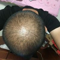 禿頂用戶圖片