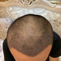 發(fā)際線用戶圖片