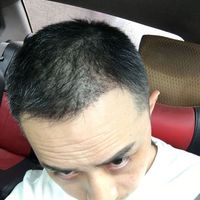 發(fā)際線用戶圖片