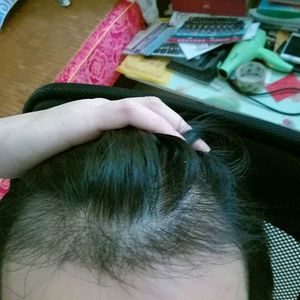 发际线分享社区