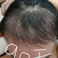 發(fā)際線用戶圖片