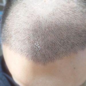 发际线分享社区