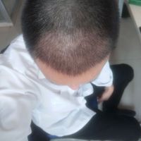 發(fā)際線用戶圖片