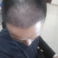 發(fā)際線用戶圖片
