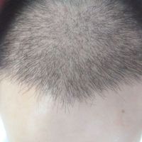 發(fā)際線用戶圖片