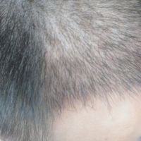發(fā)際線用戶圖片