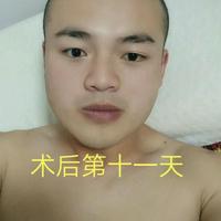 發(fā)際線用戶圖片