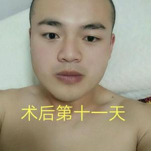发际线分享社区