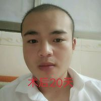 發(fā)際線用戶圖片
