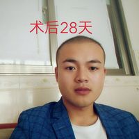 發(fā)際線用戶圖片