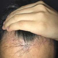 發(fā)際線用戶圖片